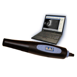 Mobile USB B-Scan 